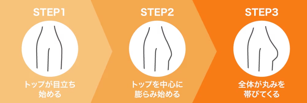 スポブラ
